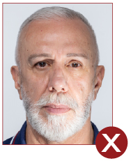 Image of unacceptable passport photo, uneven lighting
